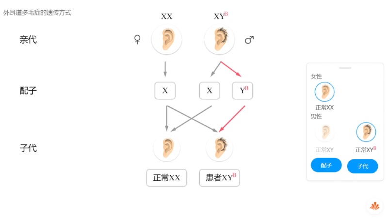 外耳道多毛症的遗传方式 火花学院